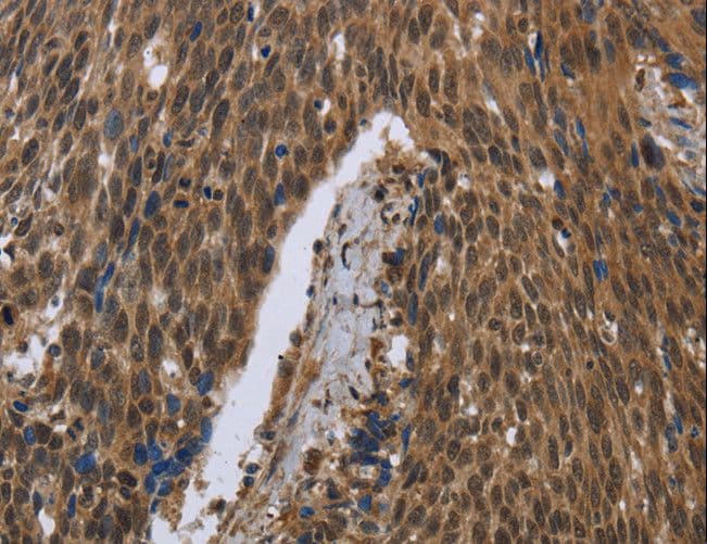 Polyclonal Rabbit anti-Human PIP / GCDFP-15 Antibody (IHC)