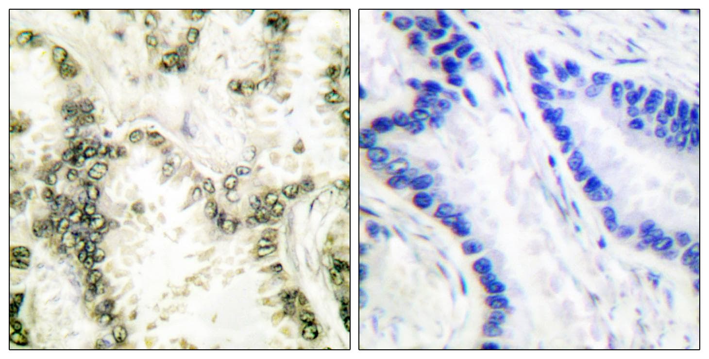 XRCC6 / Ku70 Antibody