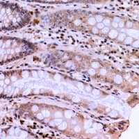 HSPB8 / H11 / HSP22 Antibody