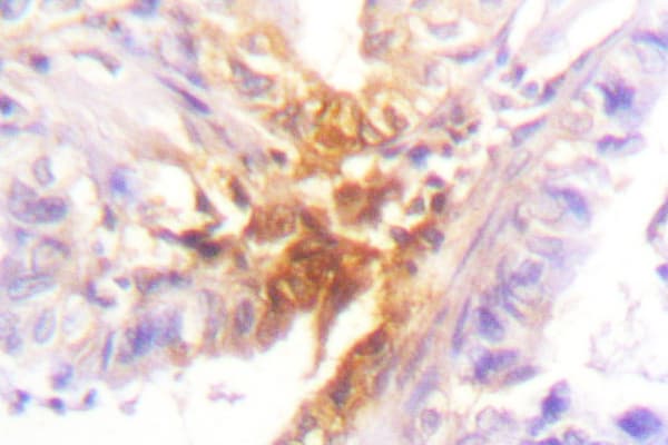 IL2RB / CD122 Antibody (Thr360)