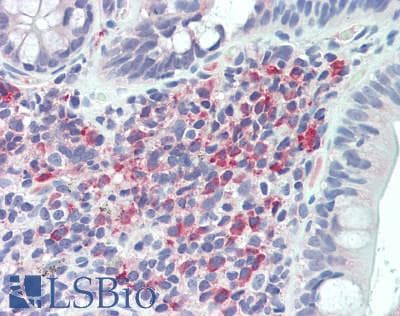 IHC-plus™ FCGR3B / CD16B Antibody (aa12-47)