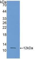 Calgizzarin / S100A11 Antibody (aa9-98)
