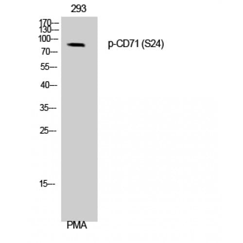 CD71 / Transferrin Receptor Antibody (10-90 aa)
