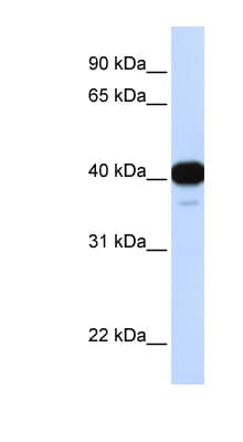 FOXL1 Antibody (aa216-265)