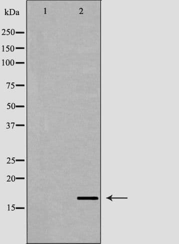 IHC-plus™ Polyclonal Rabbit anti-Human AIF1 / IBA1 Antibody (IHC, IF, WB)