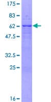 Human VAX2 Protein (Recombinant GST)