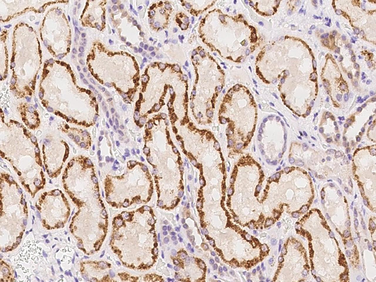 Polyclonal Rabbit anti-Human SLC35F4 Antibody (IHC)