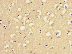 MAST1 Antibody