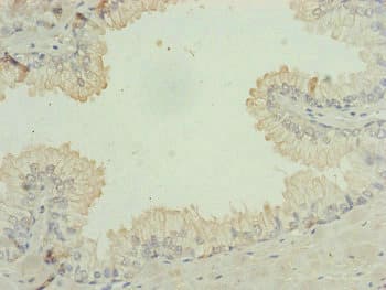 RPP25L / C9orf23 Antibody