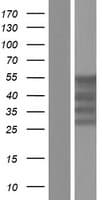 MSY2 / YBX2 Protein (Over-Expression Lysate Myc-DDK (Flag))