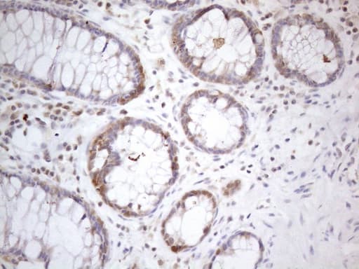 TNFSF5IP1 / CLAST3 Antibody (clone OTI1E8)