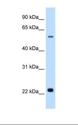 SLC17A5 Antibody (aa151-200)