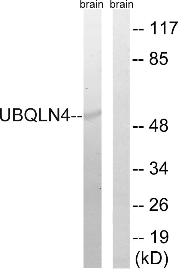 UBQLN4 Antibody (aa201-250)