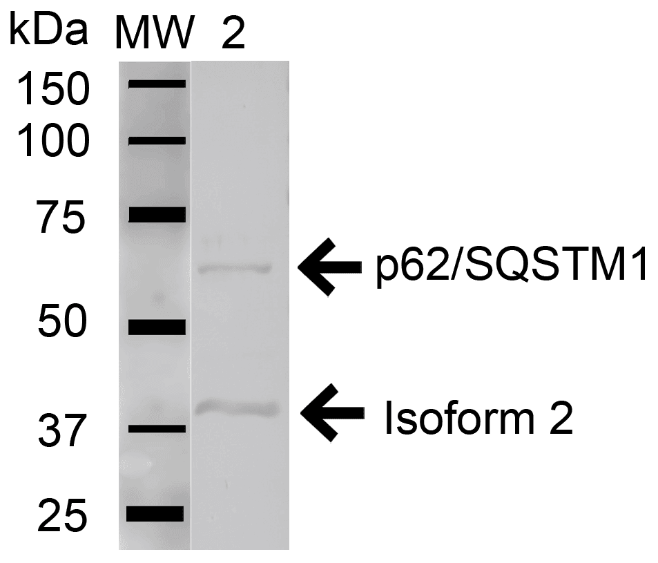 SQSTM1 Antibody