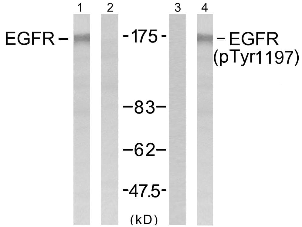 EGFR Antibody (p1197)