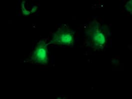 Monoclonal Mouse anti-Human Mannose Phosphate Isomerase Antibody (clone OTI1C7, Carrier-free, IHC, IF, WB)