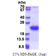 Human GTSF1 Protein (Recombinant His)