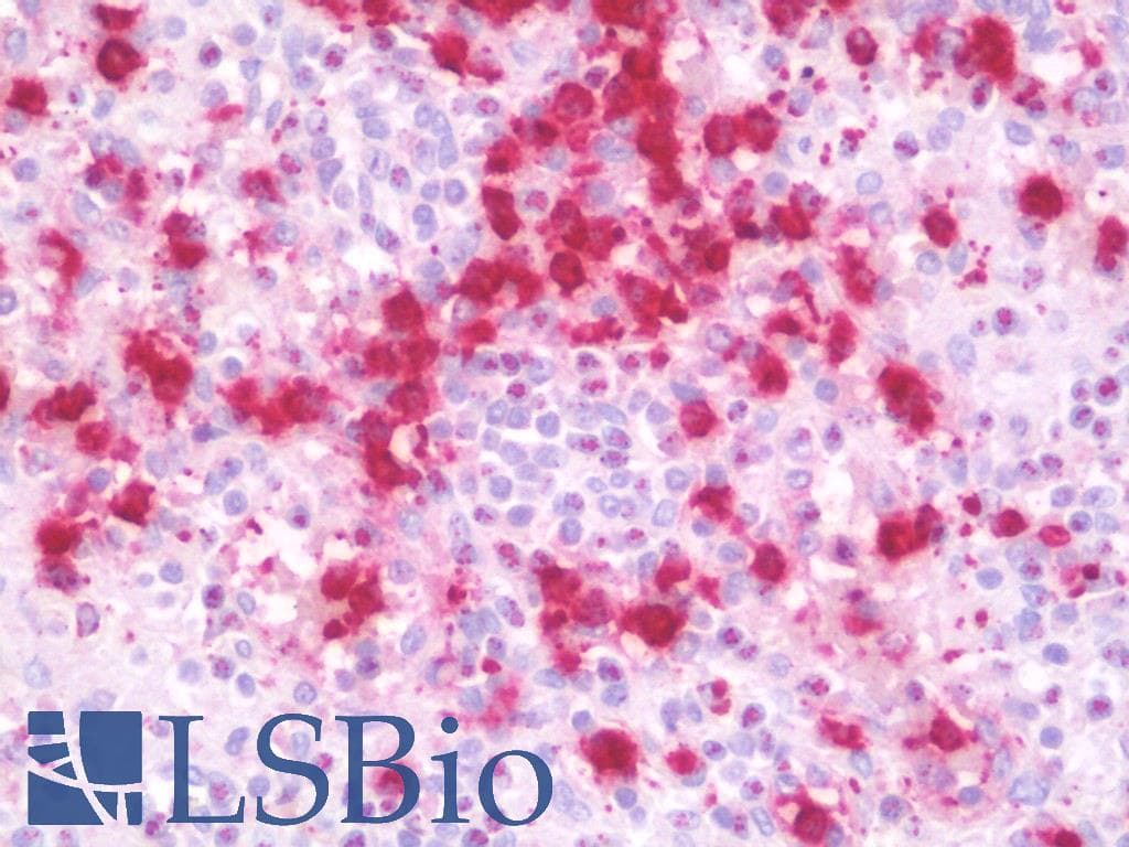 IHC-plus™ Polyclonal Rabbit anti-Human CXCR3 Antibody (IHC, IF, WB)