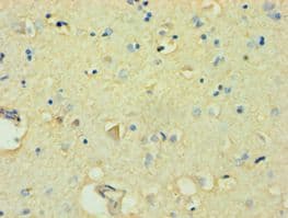 FBXW11 Antibody (aa1-140)