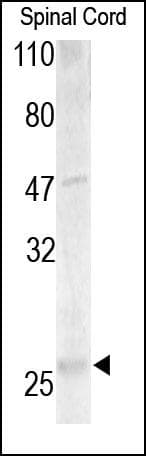 Polyclonal Rabbit anti-Human MPZ / P0 Antibody (IHC, WB)