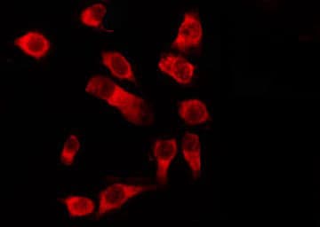 Polyclonal Rabbit anti-Human OR1D5 Antibody (IF, WB)