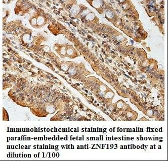 ZNF193 Antibody (aa4-216)