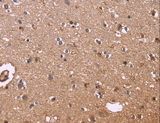 Polyclonal Rabbit anti-Human S100A13 Antibody (IHC)