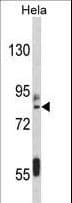 IMMT / Mitofilin Antibody (aa700-729)