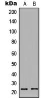 IHC-plus™ PTTG1IP / PBF Antibody (Internal)