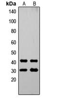 Polyclonal Rabbit anti-Human OVOL1 Antibody (N-Terminus, WB)