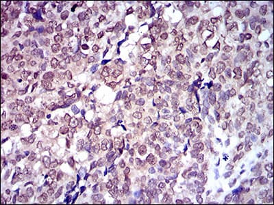 Monoclonal Mouse anti-Human SLC2A4 / GLUT-4 Antibody (clone 3G10A3, aa224-353, IHC, IF, WB)