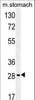 MGC11296 / BRMS1L Antibody (aa1-30)