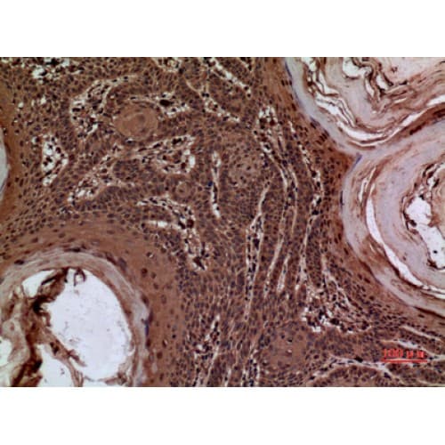 Alpha-1-Antichymotrypsin Antibody (251-300 aa, Internal)