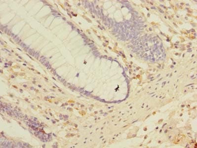 LRRC2 Antibody