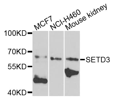 SETD3 Antibody