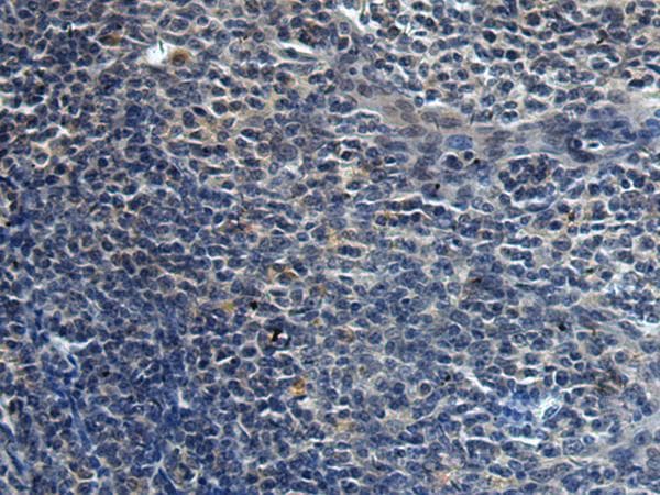 Polyclonal Rabbit anti-Human HAUS6 / FAM29A Antibody (IHC)
