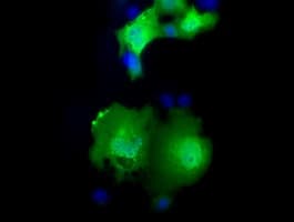 MOBKL2B / MOB3B Antibody (clone OTI7G2)