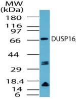 IHC-plus™ Polyclonal Rabbit anti-Human DUSP16 / MKP7 Antibody (aa600-650, IHC, WB)