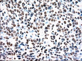 TYRO3 Antibody (clone OTI2C4)