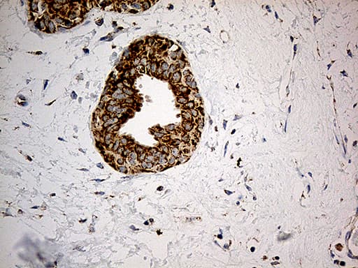 ACAD9 Antibody (clone OTI1D4, Carrier-free)