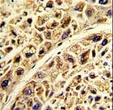 Polyclonal Rabbit anti-Human PRELP / Prolargin Antibody (aa257-286, IHC, WB)