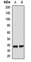 Polyclonal Rabbit anti-Human FBXO2 Antibody (WB)