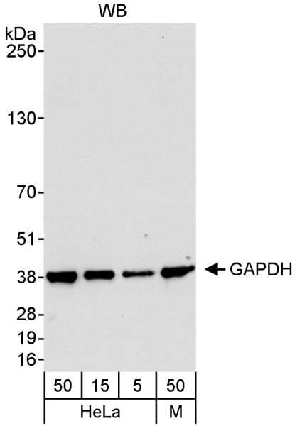IHC-plus™ Polyclonal Rabbit anti-Human GAPDH Antibody (aa250-300, IHC, WB)