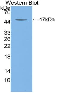 CSF2 / GM-CSF Antibody (aa18-144, Cy3)