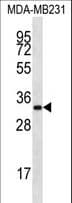 LIX1L Antibody (aa160-189)