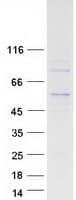 Human ADPGK Protein (Recombinant Myc-DDK (Flag))