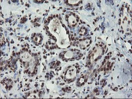 Mannose Phosphate Isomerase Antibody (clone OTI4G7)