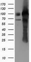 PUS7 Antibody (clone OTI5F12)