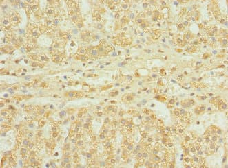 Polyclonal Rabbit anti-Human UBASH3B / STS-1 Antibody (IHC)