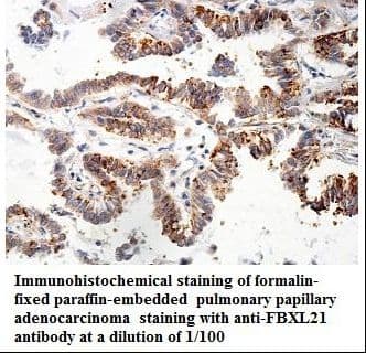 FBXL21 Antibody (aa1-138)